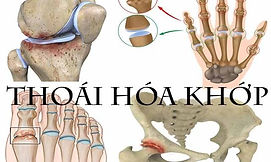 benh-thoai-hoa-khop_edited.jpg