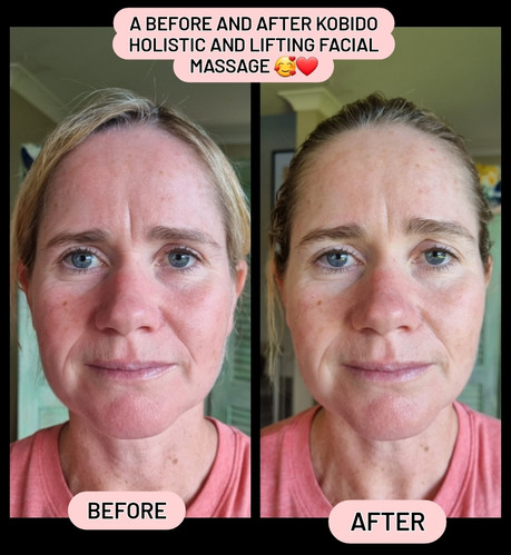 Facial Kobido Masaje Facial Rejuvenecedor Japones Masaje Relajante