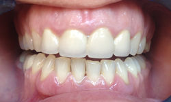 Before
