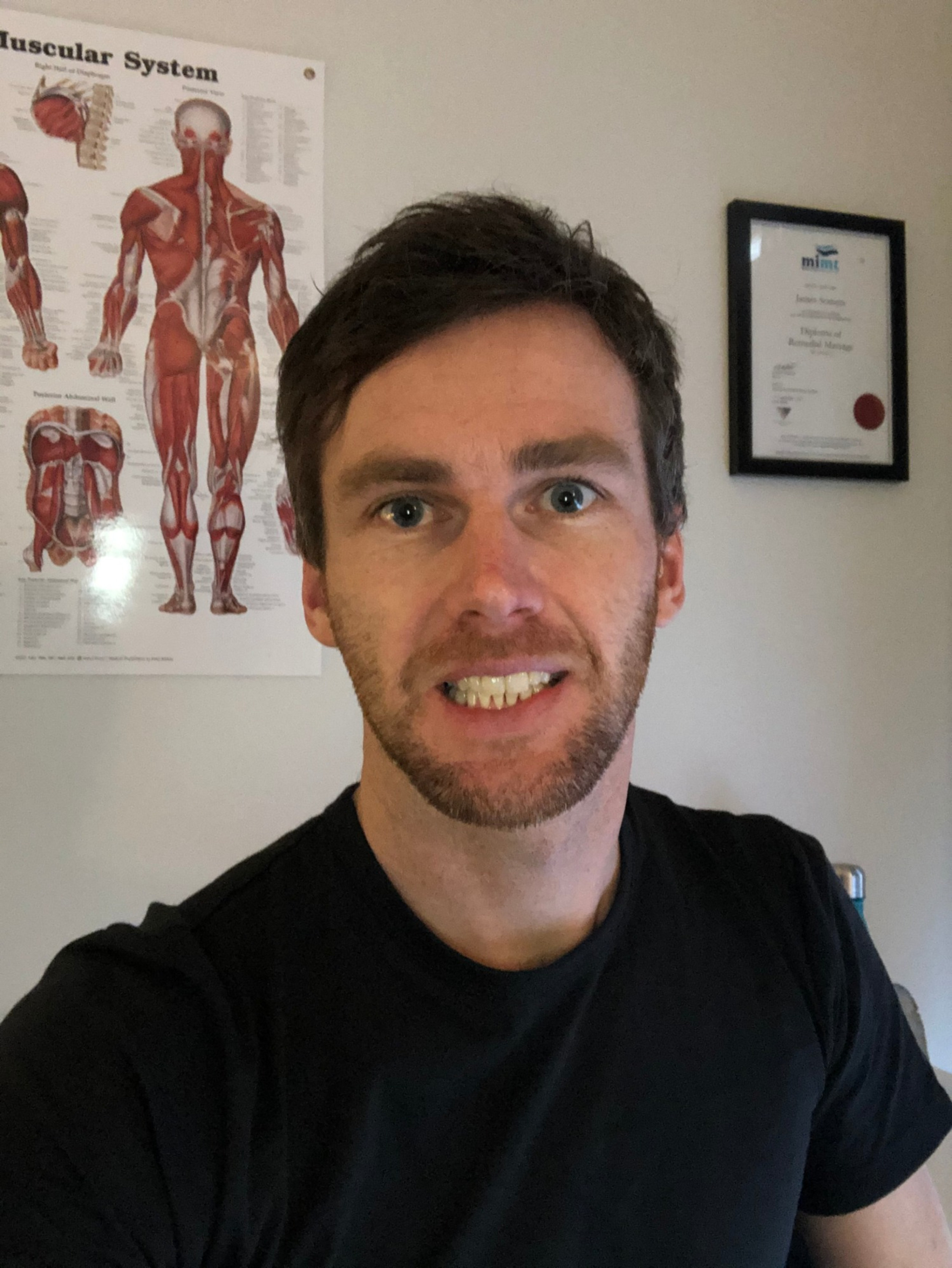 Muscle Pain Therapy James Somers Remedial Massage Australia muscle-pain-therapy-james-somers-remedial-massage-australia