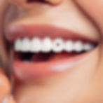 228-Star_with_ruby_whitegold_tooth-gem-twinkles-dental-jewelry_in_smile.jpg