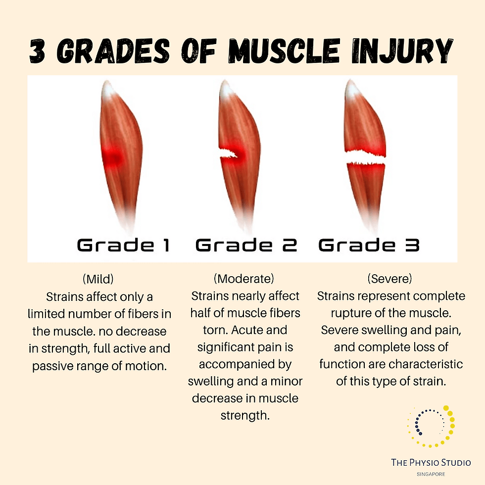 3 grades of muscle injury