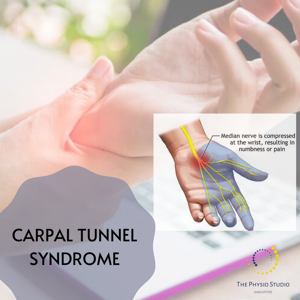 What is Carpal Tunnel Syndrome?