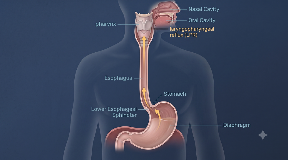 Diagram showing how acid reflux travels from the stomach to the esophagus in GERD, and further to the throat in LPR