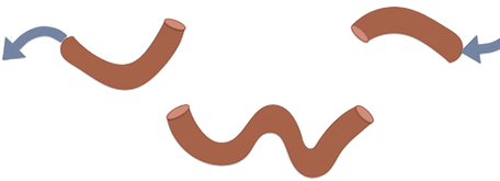 Cystectomy and Urinary Diversion 04.png