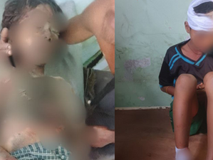 Boy Killed, Two Injured in Unexploded Ordnance Blast in Gwa Township