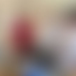 У ВІДДІЛЕННІ ДИТЯЧОЇ ОФТАЛЬМОЛОГІЇ З'ЯВИЛОСЯ НОВЕ ДІАГНОСТИЧНЕ ОБЛАДНАННЯ