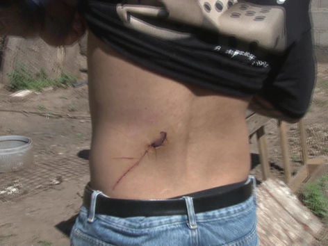 Una familia denuncia ataques constantes de sus vecinos, uno de ellos terminó apuñalado: “Queremos vivir tranquilos”