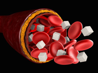 🩺 Why More People Are Using Continuous Glucose Monitors. Even Without Diabetes