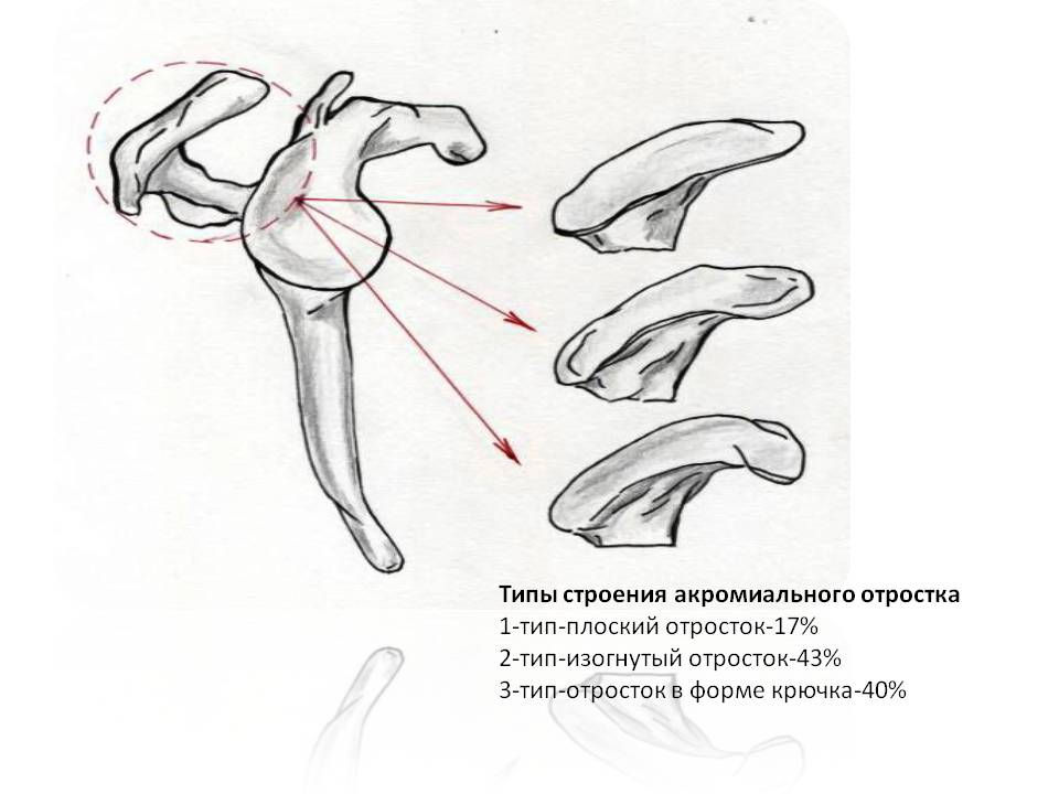 Плечо на схеме. Схема плечевого сустава. Схема сязки плечевой кости. Операция Ткаченко плечо схема. Схема плечевого сустава человека с сухожилиями фото и описание.
