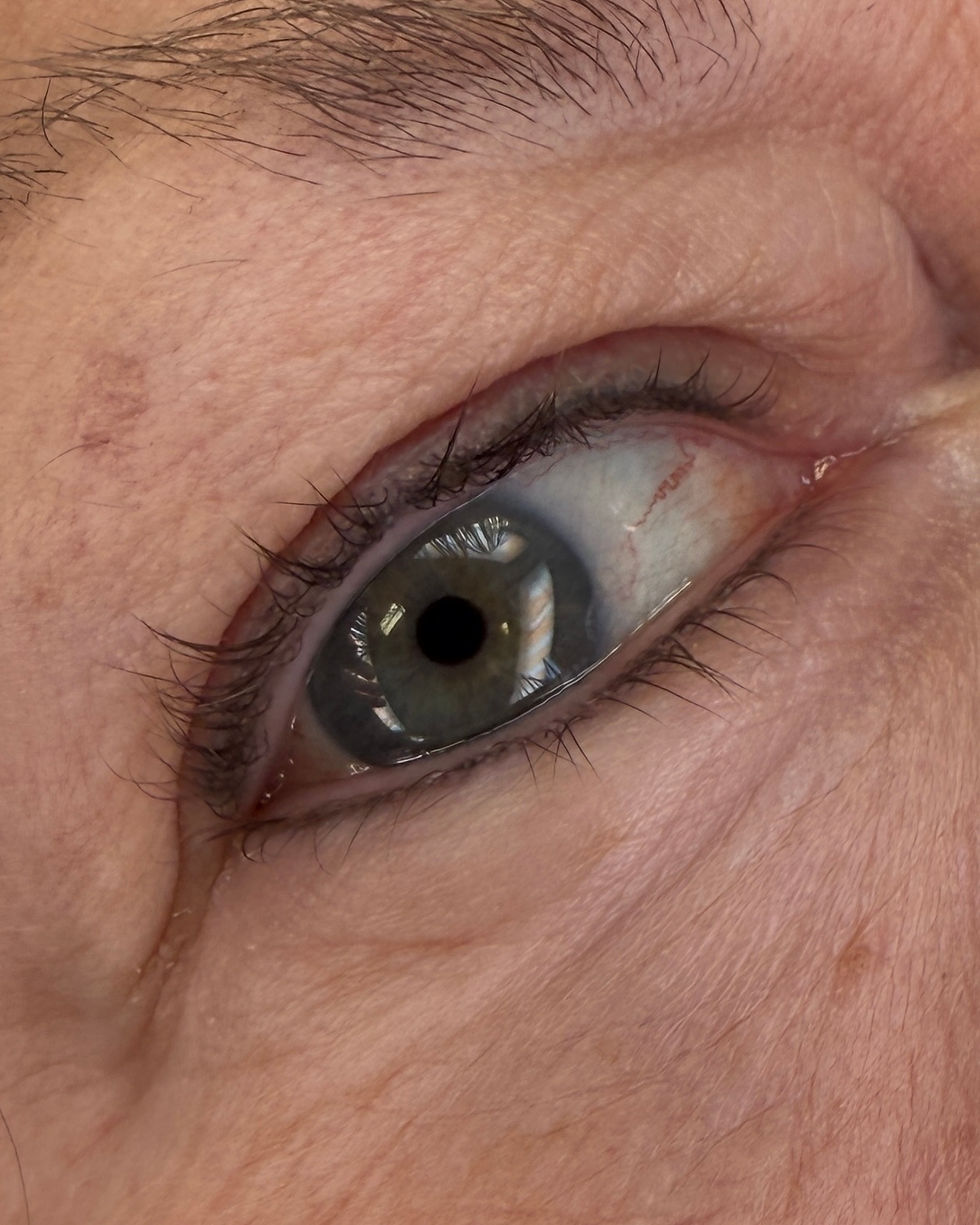 20250324_205018257_iOS