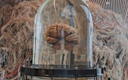Cerebro humano en un foto de formol
