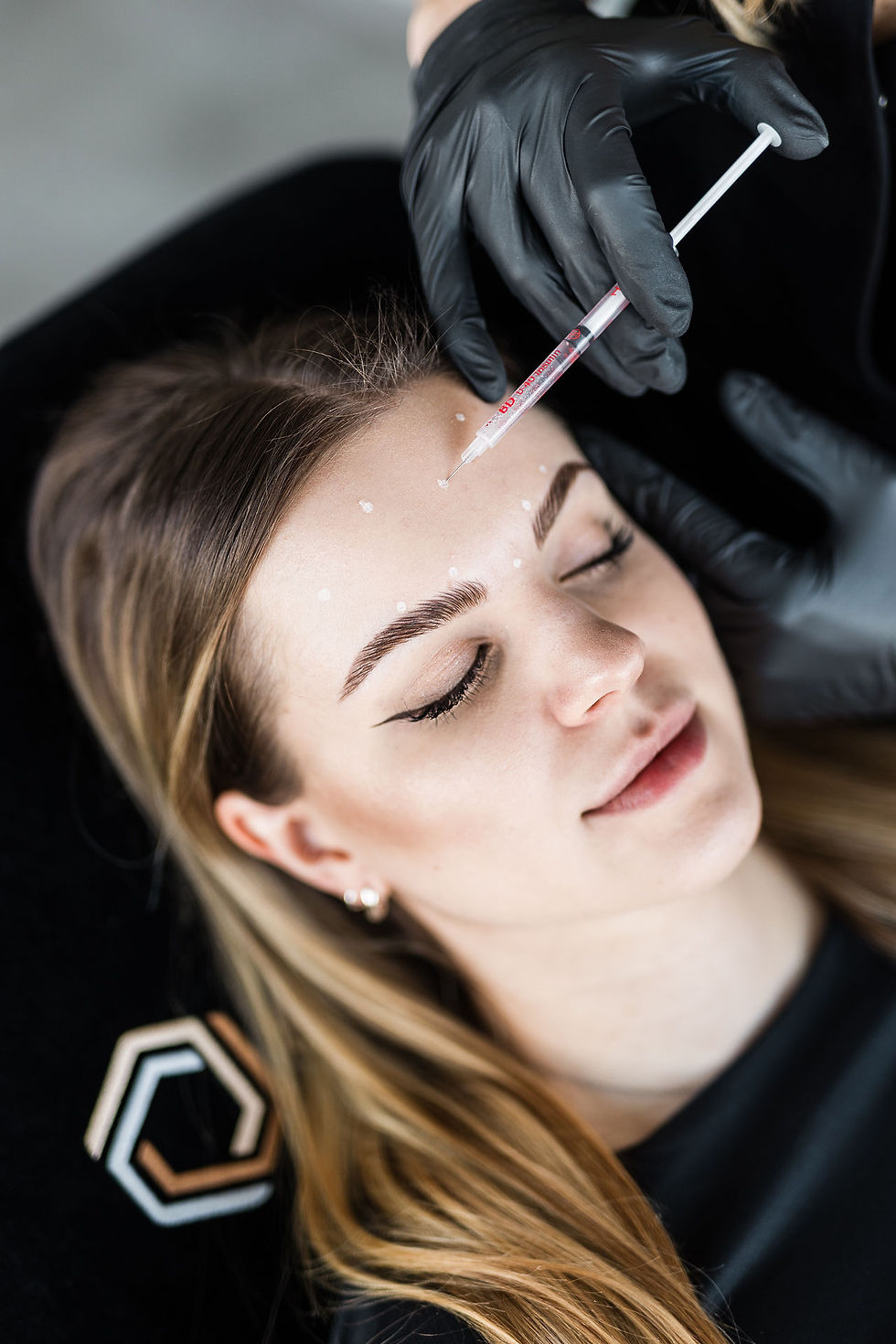 Full Face Botox – kompleksowe odmłodzenie twarzy
