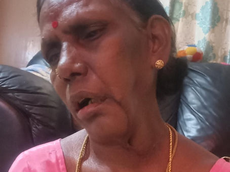 The wrong side of Oral Cancer