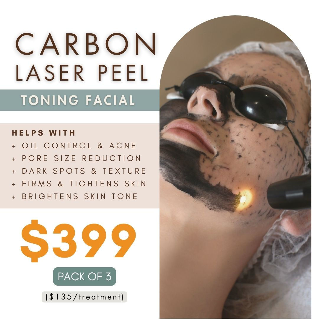 CARBON LASER PEEL - Pack of 3