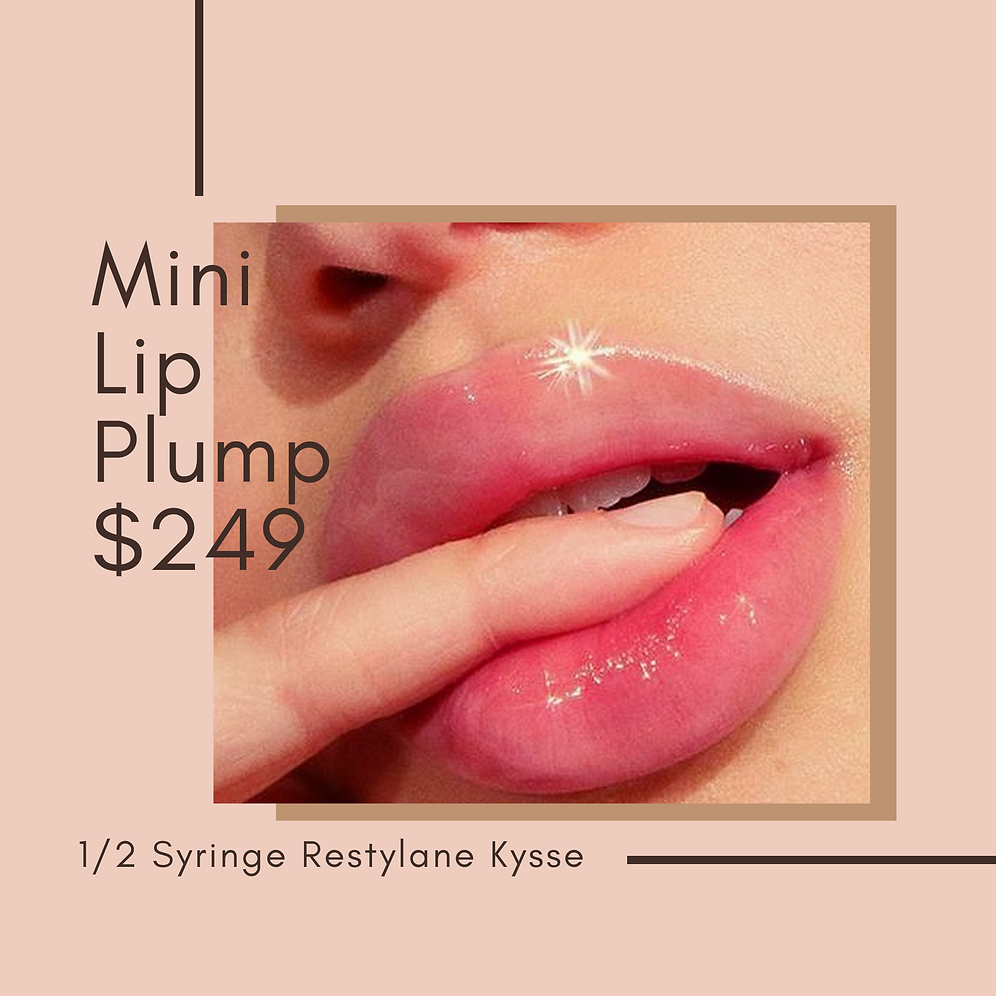 0.5 SYRINGE OF RESTYLANE KYSSE ® LIP FILLER | Sunandshademed