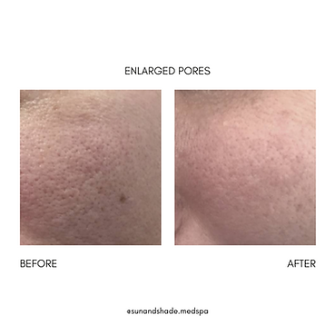 ENLARGED BEFORE AND AFTER.png