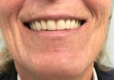 Grinning Ear-to-Ear!