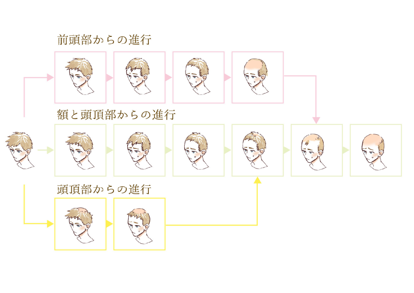 usuge.png