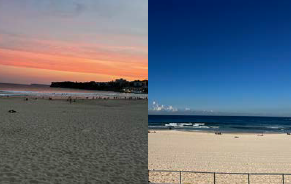 My life on Bondi Beach