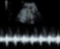 20wk hb_edited.jpg