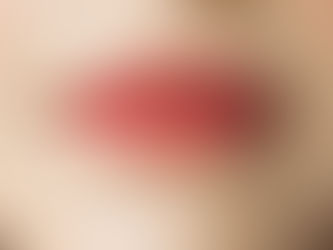 Przebarwienia skóry – skąd się biorą i jak je skutecznie usunąć?