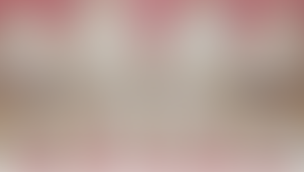 Understanding White Spot Lesions: Prevention Tips for A Healthy Smile