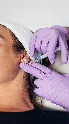 botox treatments dorset