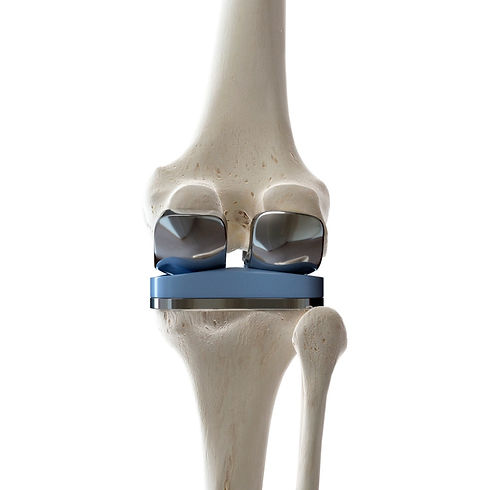 Mr Simon Garrett Knee Replacement Bourne