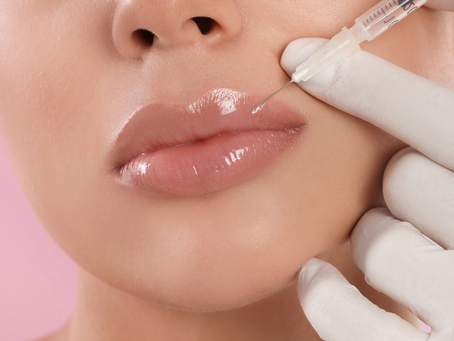 How Long Do Lip Fillers Last