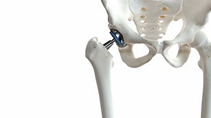 Mr Simon Garrett Hip Replacement Dorset.