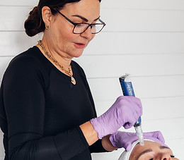 Microneedling treatments dorset