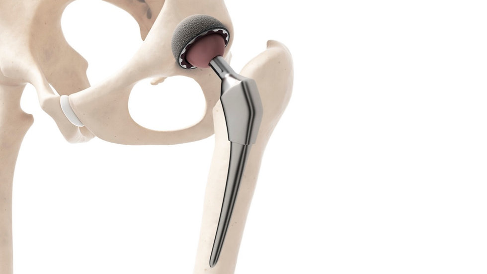 Mr Simon Garrett Hip Replacement Dorset.