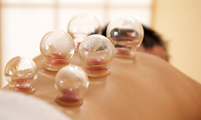 Cupping Therapy