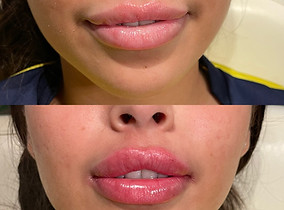 Facetune_20-11-2022-18-42-10.jpg