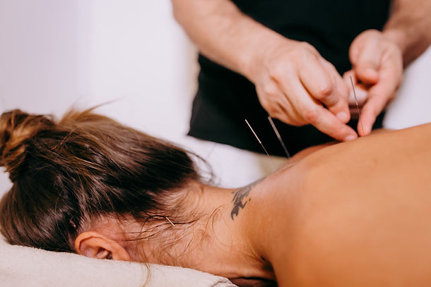 DryNeedling Site.jpeg