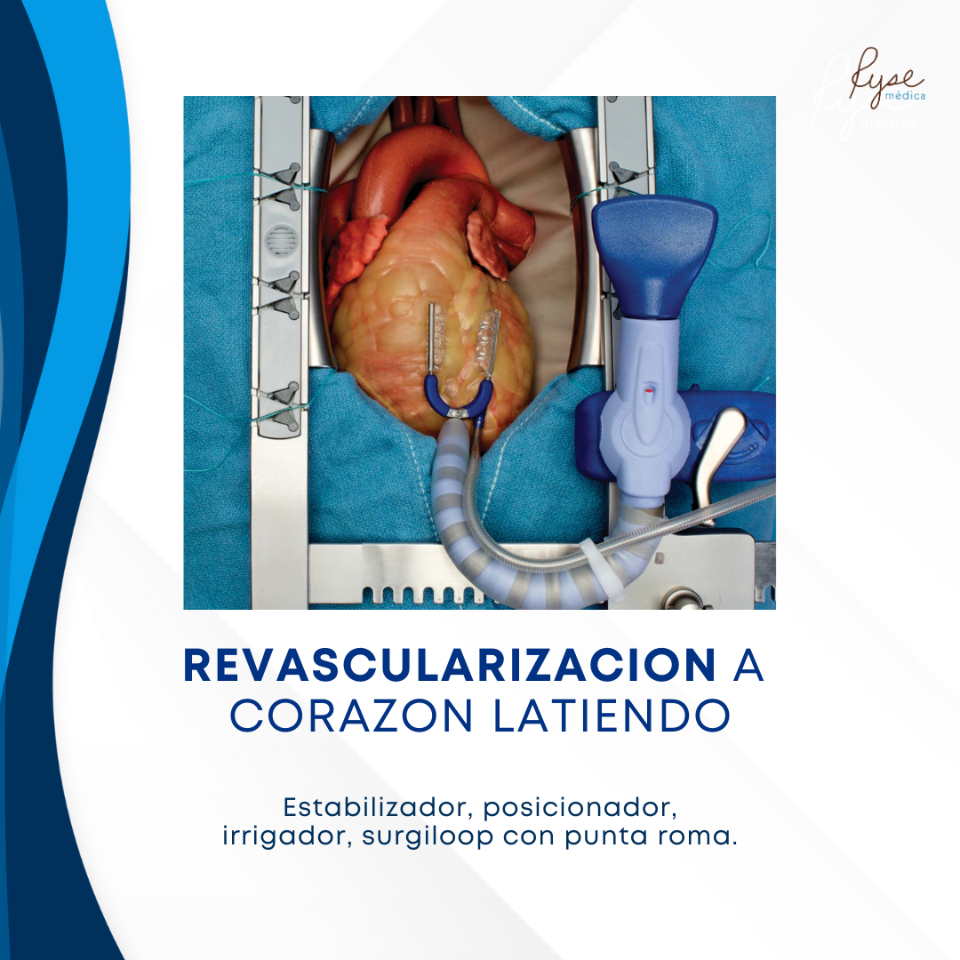 REVASCULARIZACION A  CORAZON LATIENDO