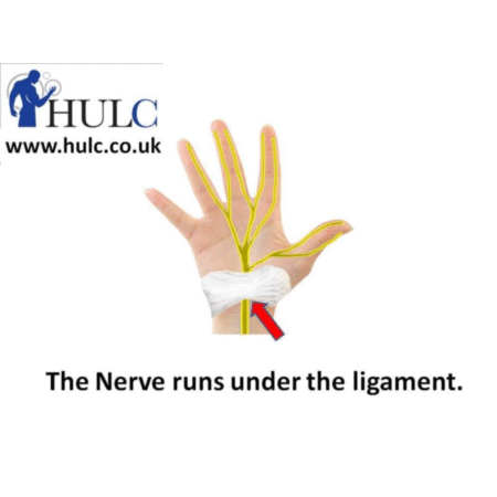 Median Nerve and Carpal Tunnel