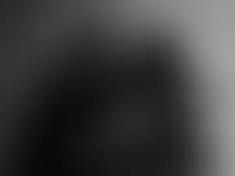 Liam Payne’s Cause of Death Confirmed as Polytrauma