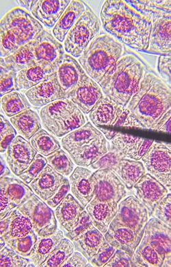 Mitose Phases (1)