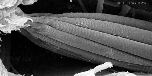 Fibres muscle 1