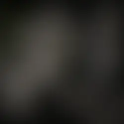 Piercing anatomisi ve farklı kulak piercing bölgeleri