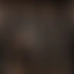 Dövme iyileşme süreci gün gün ve yeni dövmenin iyileşme evreleri