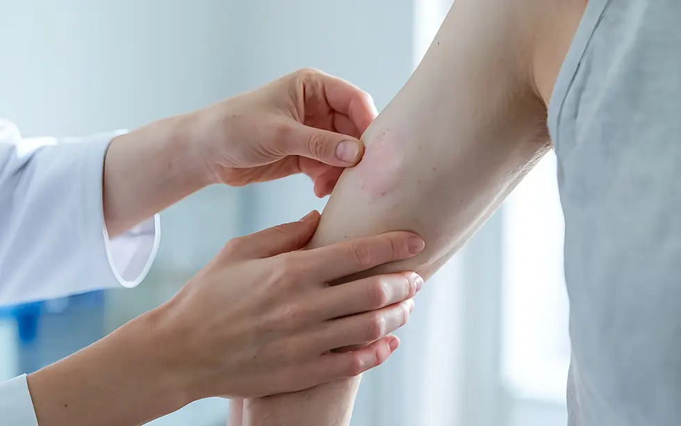 アレルギー系疾患