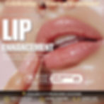 lip filler