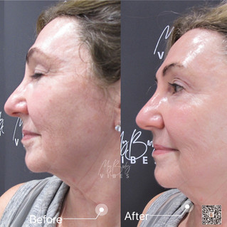 ulfit full face
