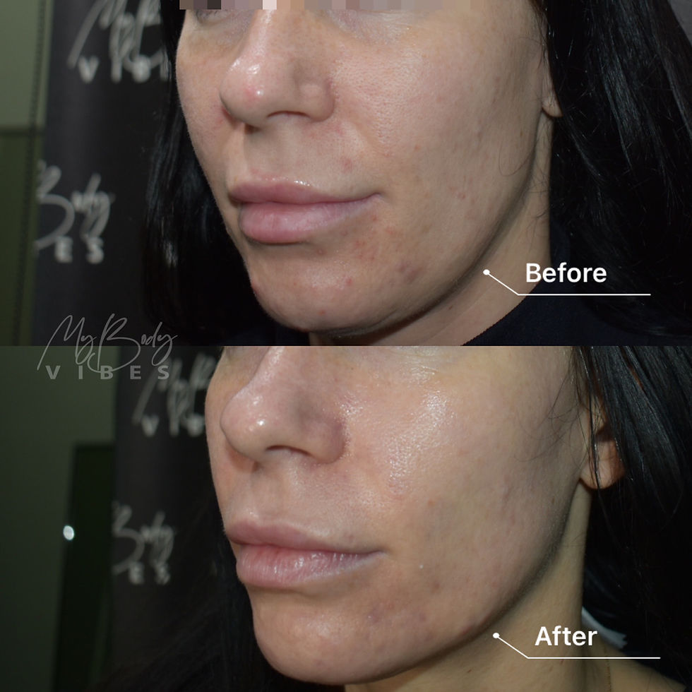 Thumbnail: Facial Treatments - Before and After - Image 7