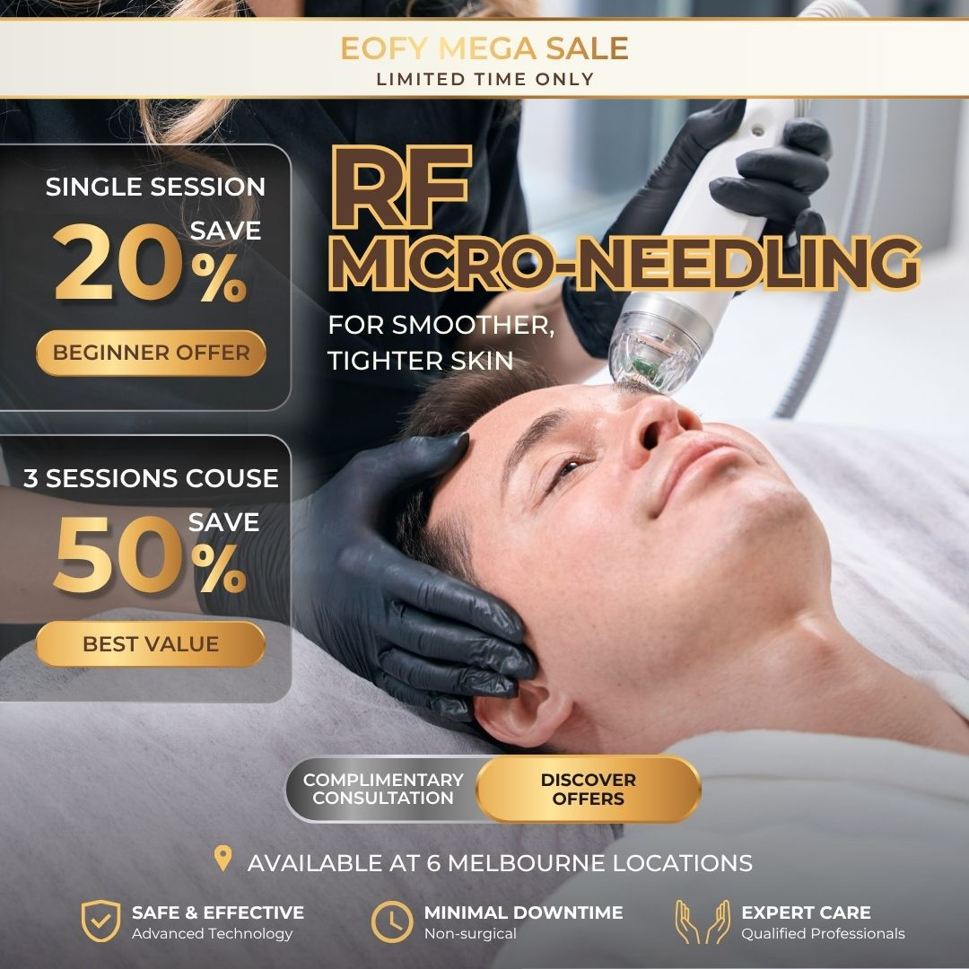 Fractional RF Micro-Needling (3 Session Deal)