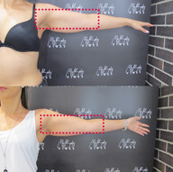 fat freezing upper arms