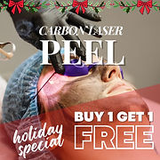 carbon laser peel.jpg